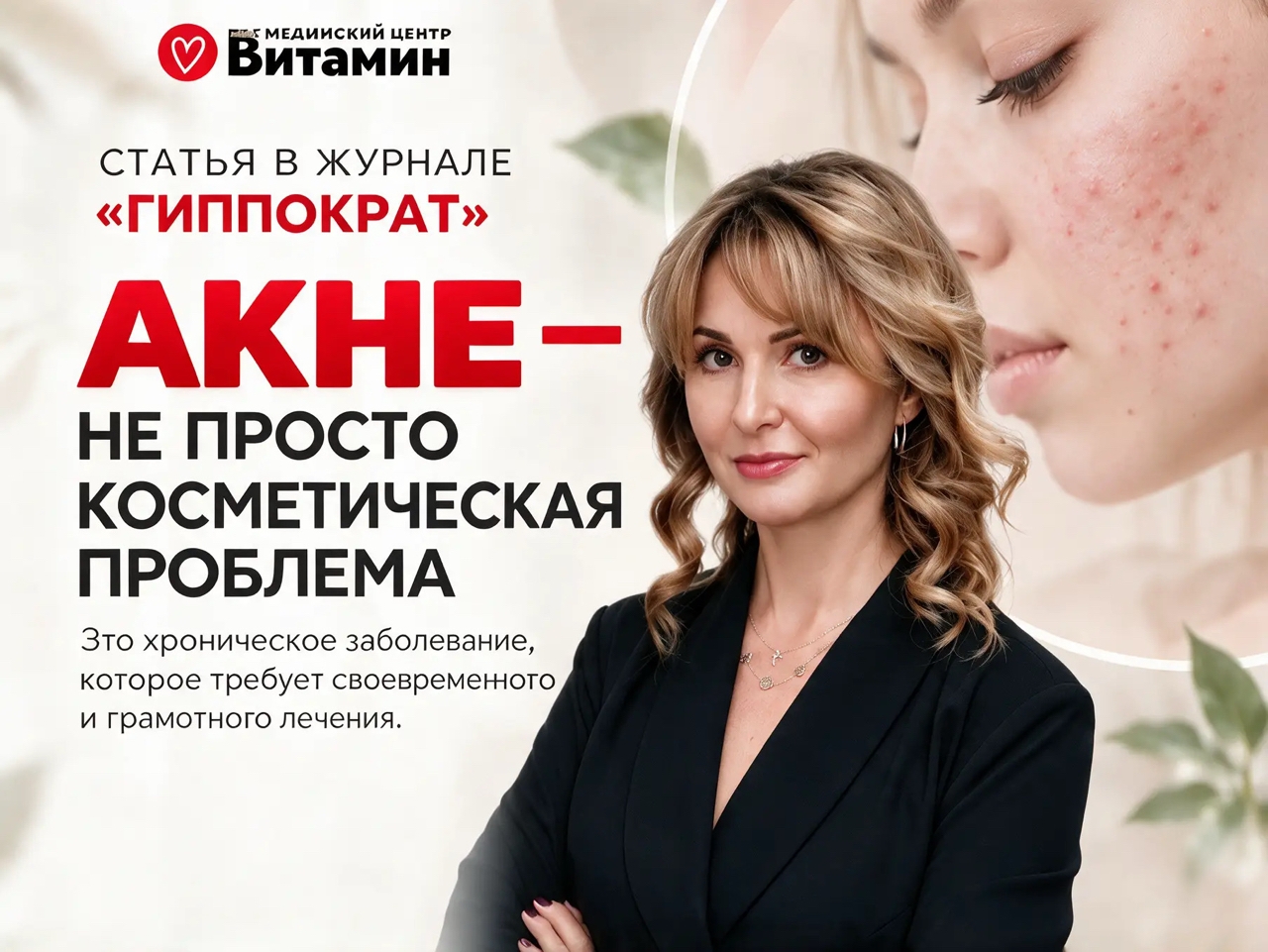 акне гиппократ